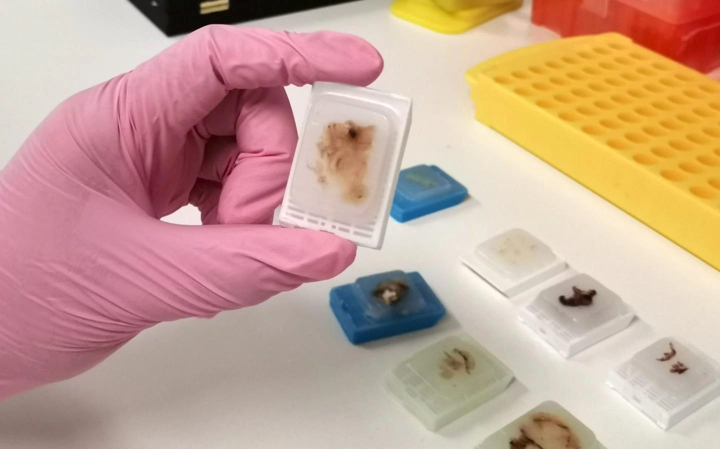 FFPE blokje aanmaken door inbedding